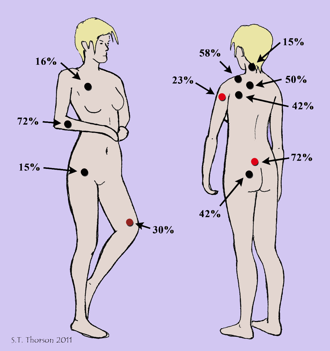 Eliminate Neck Pain